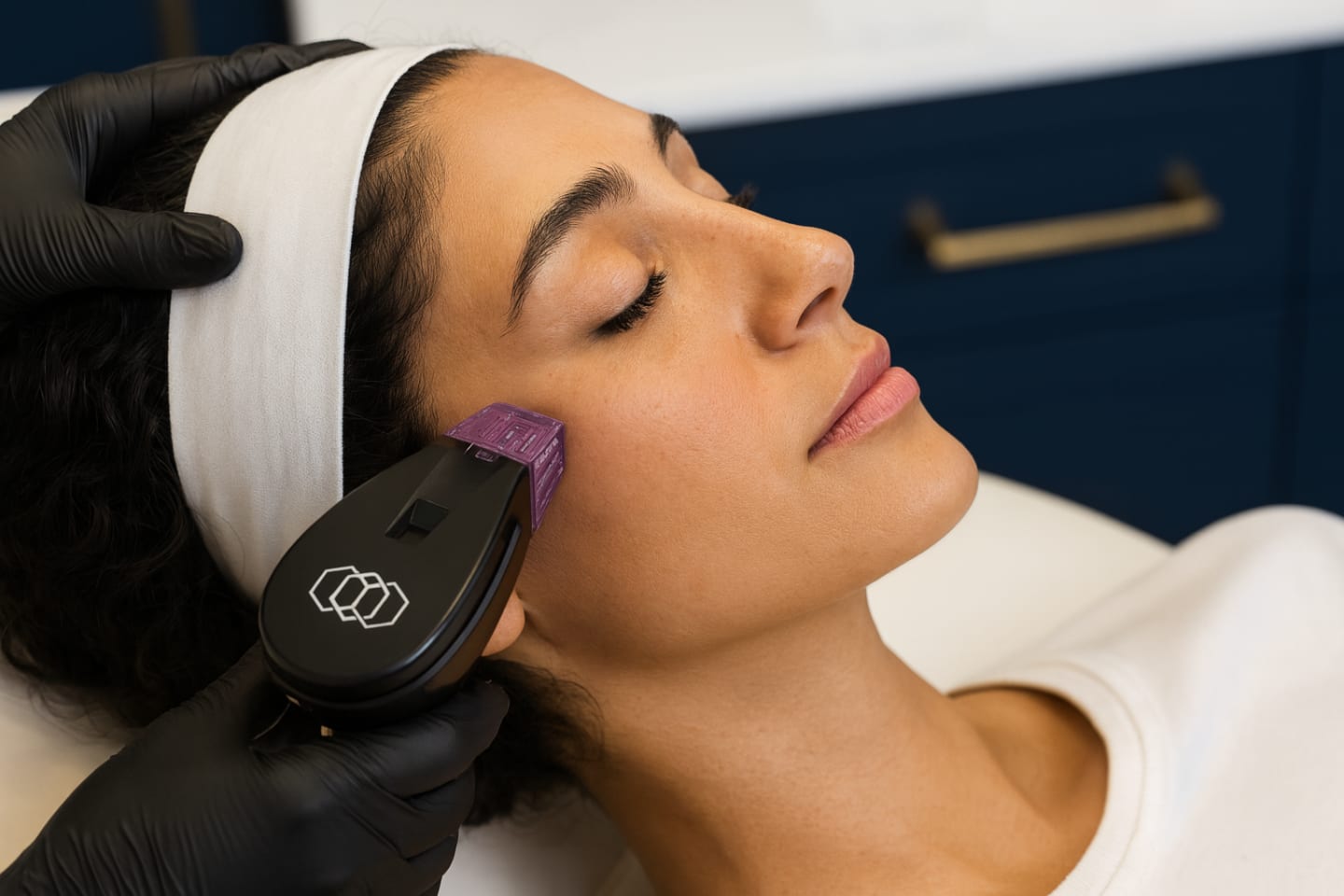 Morpheus8 Radiofrequency Microneedling